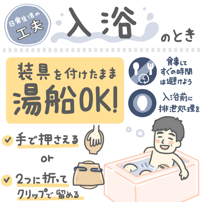 ストーマ（人工肛門‧人工膀胱）のケア方法と日常生活の工夫と注意点｜がんになっても
