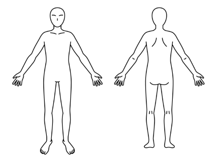 2. 痛む場所