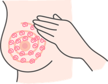 セルフチェックの方法3
