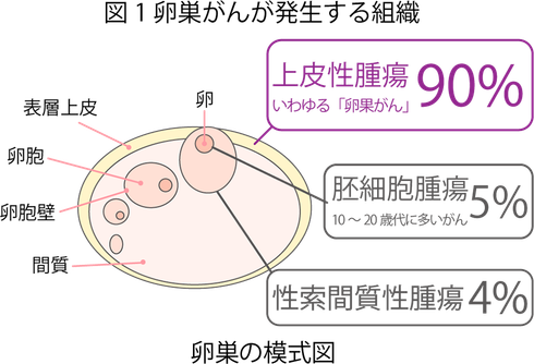 卵巣がんが発生する場所