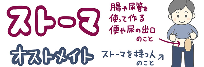 ストーマ（人工肛門‧人工膀胱）