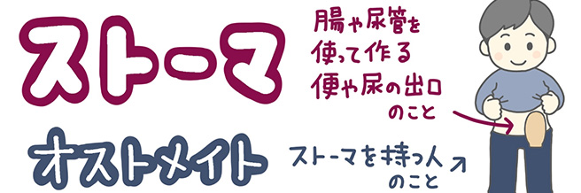 ストーマ（人工肛門‧人工膀胱）のケア方法と日常生活の工夫