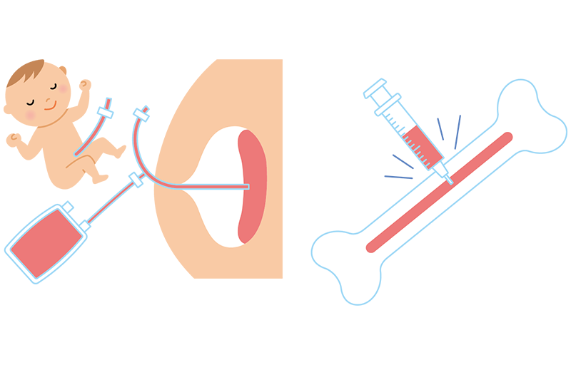 1.	移植方針の思いもよらない変更、失望しながらも決断へ