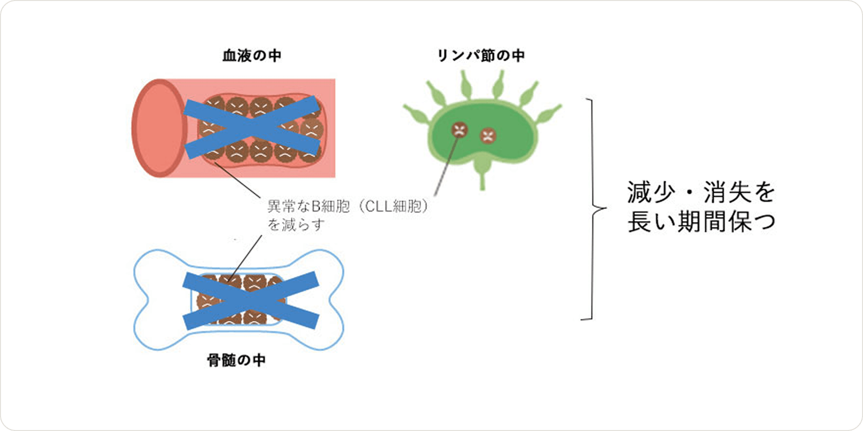 画像 異常なB細胞（CLL）の減少・消失を長い期間保つ