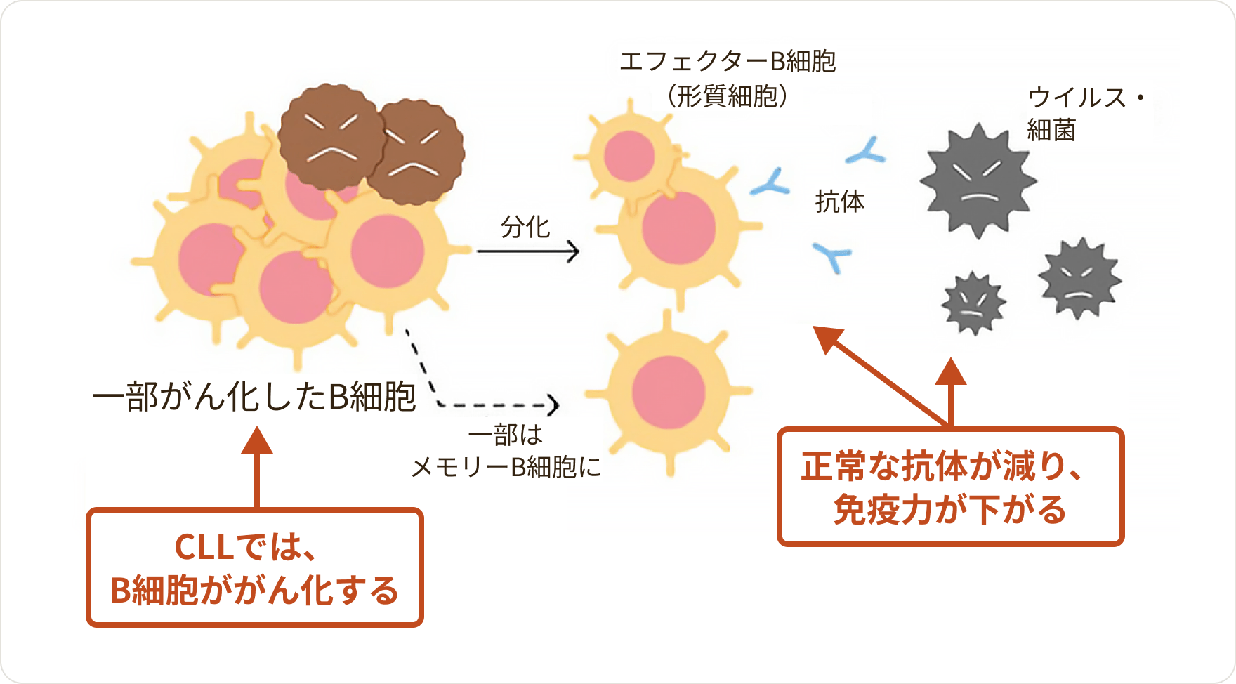 画像 CLLでB細胞ががん化すると、正常な抗体がつくれなくなり、ウイルス・細菌を効率よく攻撃できにくくなります