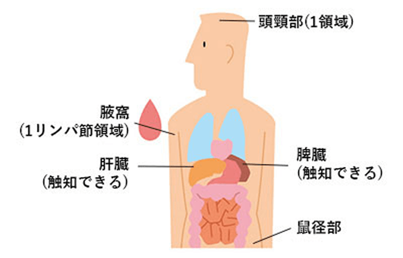 画像 Binet（ビネ）分類