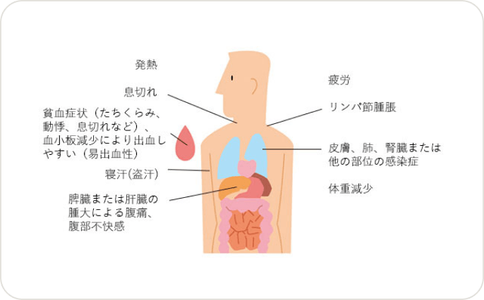 画像 CLL細胞が体内で増えてくると、症状が出てくる