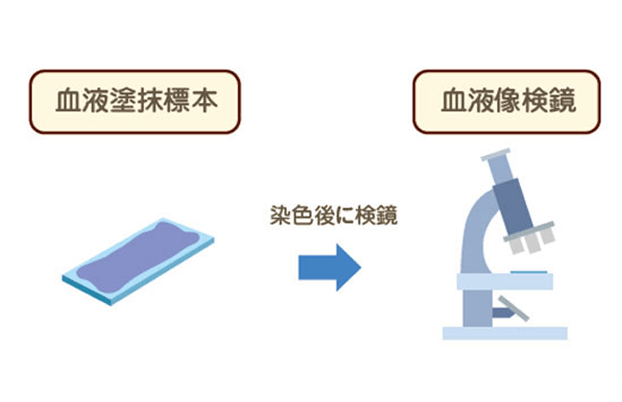 画像 血液塗抹（とまつ）標本
