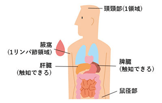 画像 Binet（ビネ）分類