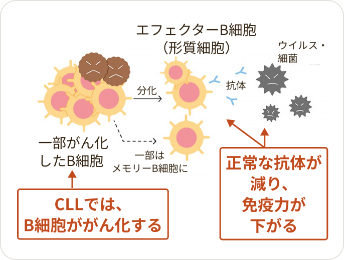 画像 CLLでB細胞ががん化すると、正常な抗体がつくれなくなり、ウイルス・細菌を効率よく攻撃できにくくなります