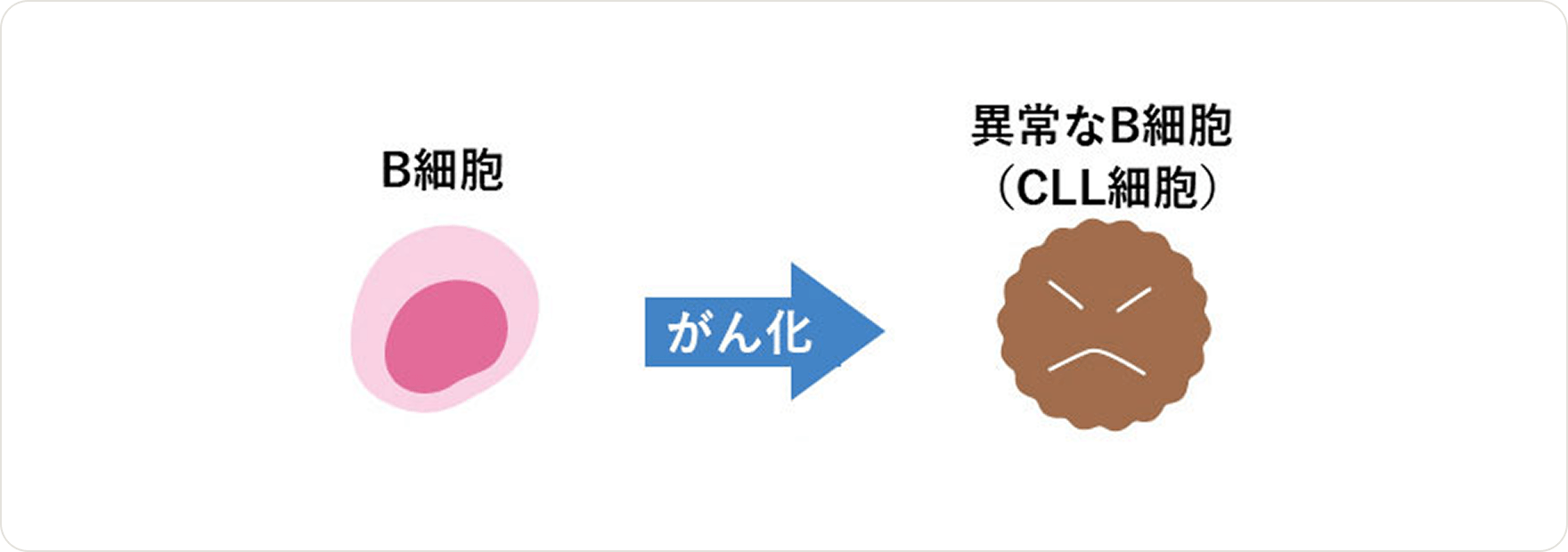 画像 B細胞のがん化