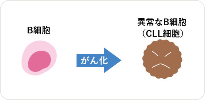画像 B細胞のがん化