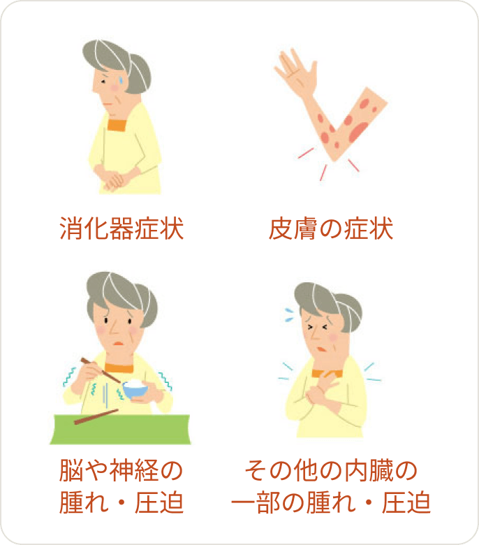 画像 腫れ以外の症状