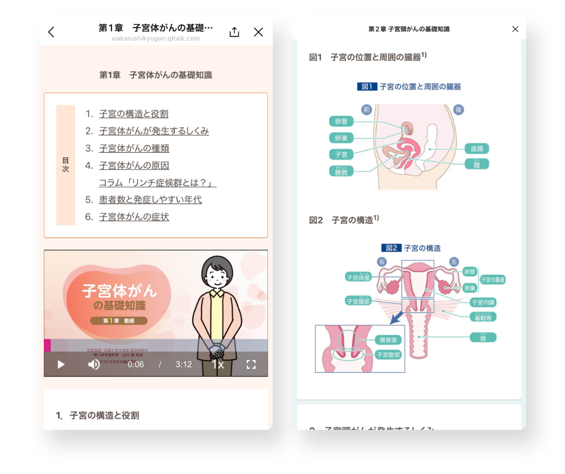 「子宮がんを知ろう」画面イメージ