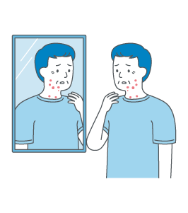 塗り薬やお薬を飲んで副作用の症状をやわらげます