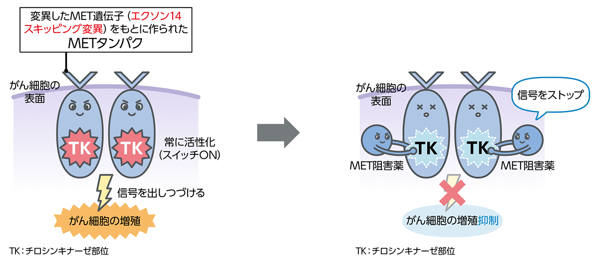 がん細胞を増殖・転移させる「MET遺伝子変異」