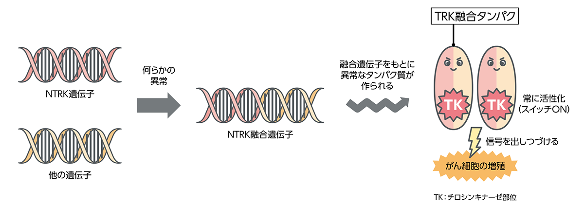 NTRK遺伝子融合がある人に効果が期待できる「TRK阻害薬」