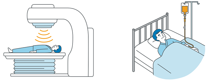 Ⅲ期非小細胞肺がんでの放射線治療と免疫療法