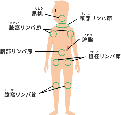 扁桃、頸部リンパ節、腋窩リンパ節、脾臓、腹部リンパ節、鼠経リンパ節、膝窩リンパ節