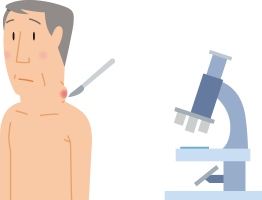 生検のイメージイラスト