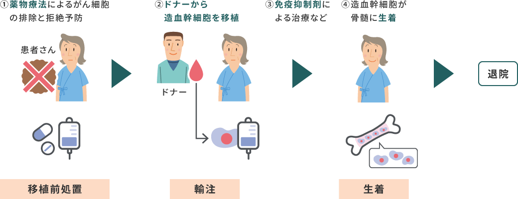 ①移植前処置：薬物療法によるがん細胞の排除と拒絶予防、②輸注：ドナーから造血幹細胞を移植、③免疫抑制剤による治療など、④生着：造血幹細胞が骨髄に生着、退院
