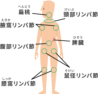 扁桃、頸部リンパ節、腋窩リンパ節、脾臓、腹部リンパ節、鼠経リンパ節、膝窩リンパ節