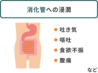 消化管への浸潤：吐き気、嘔吐、食欲不振、腹痛など