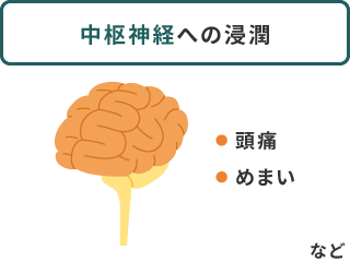 中枢神経への浸潤：頭痛、めまいなど