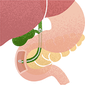 プラスチックステント